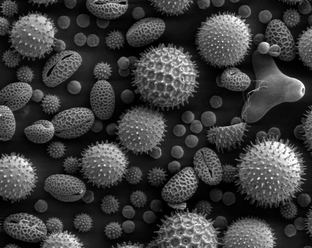 allergy statistics statisticbrain
